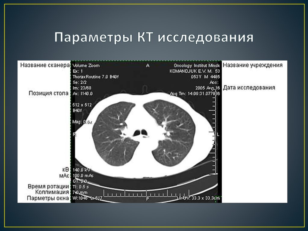 Зона исследования. Протоколы сканирования кт. Параметры кт сканеров. Параметры сканирования компьютерная томография. Режимы сканирования компьютерной томографии.