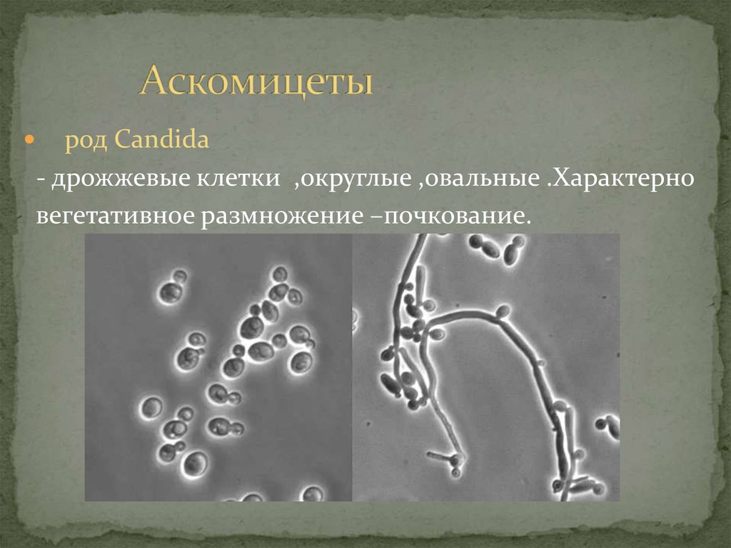 Дрожжеподобные грибы candida. Дрожжеподобные грибы рода Candida. Грибы рода Candida размножаются. Дрожжи аскомицеты. Сумчатые грибы дрожжи.