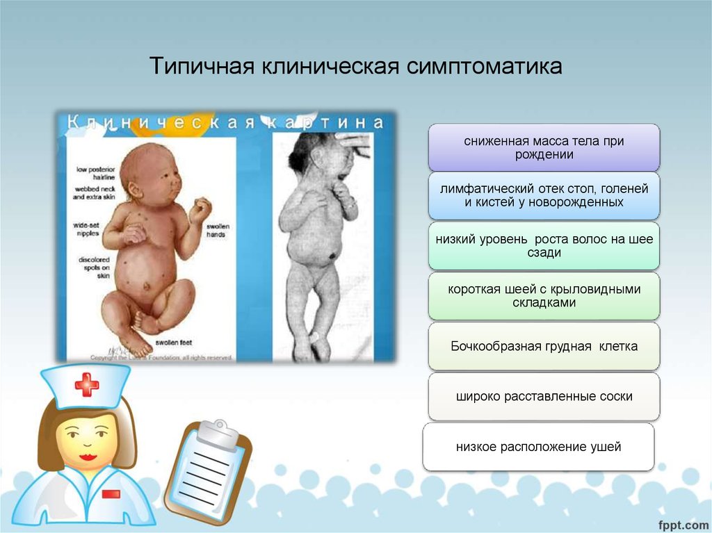 Физиологическое снижение массы новорожденного составляет. Низкая масса тела при рождении. Низкая масса тела у новорожденных. Изменение массы тела новорожденного. Низкий вес при рождении.