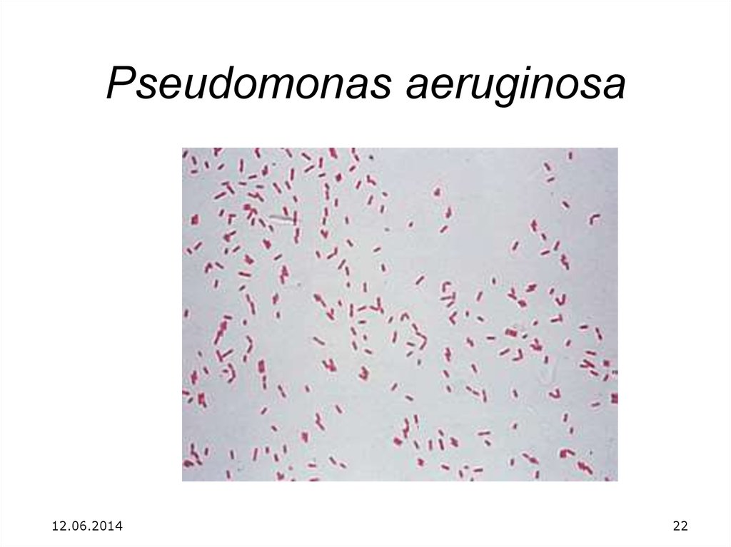 Pseudomonas aeruginosa. Pseudomonas aeruginosa окраска по Граму. Синегнойная палочка окраска по Граму. Синегнойная палочка под микроскопом. Синегнойная палочка микроскопия.