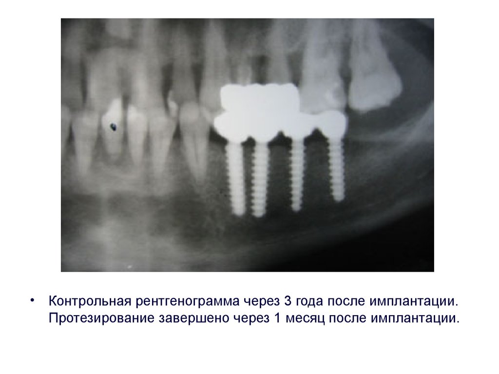 Дентальная фотография презентация