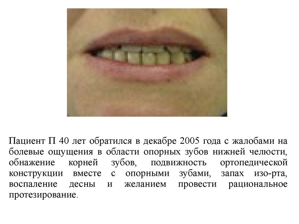 Дентальная фотография презентация