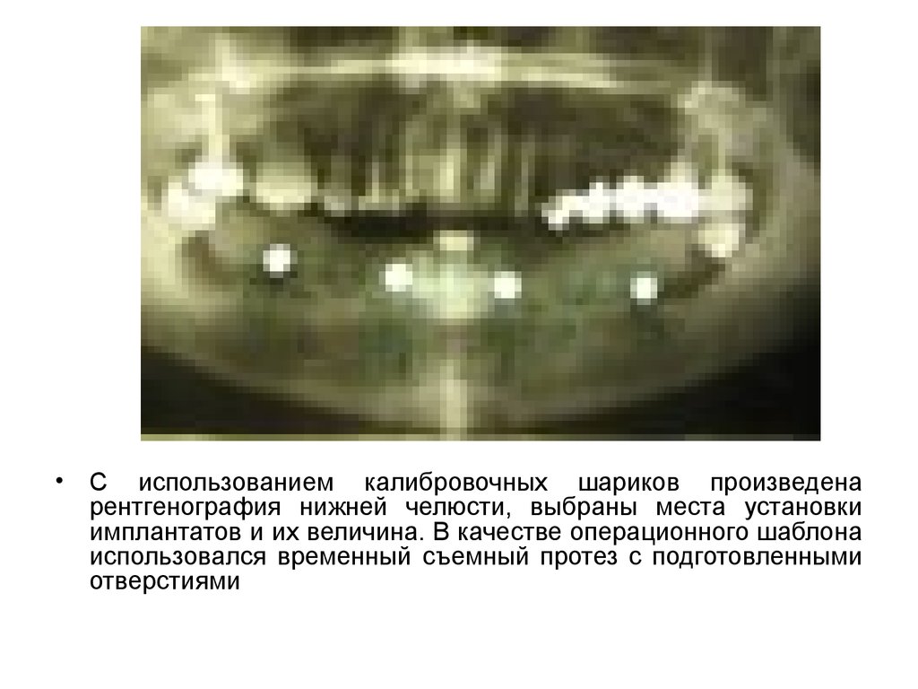 Дентальная фотография презентация