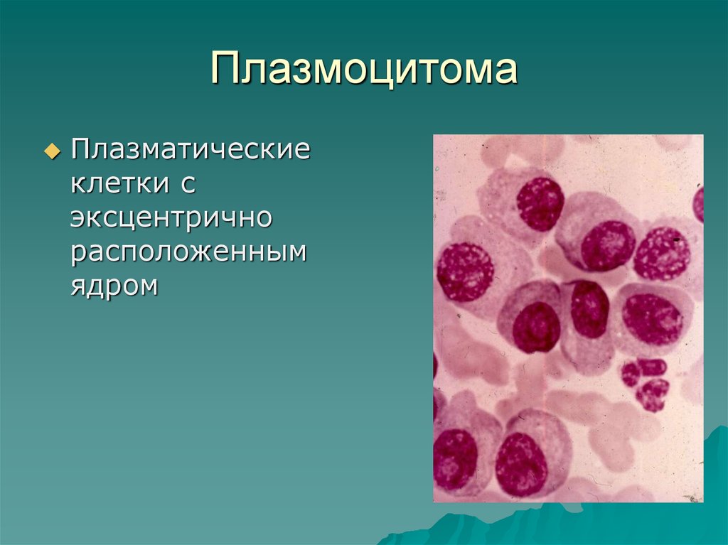Плазматические клетки ребенка