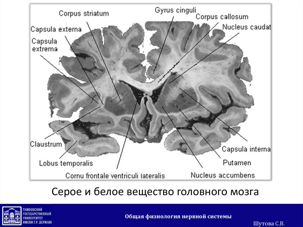 Полосатое тело мозга. Ядра в белом веществе головного мозга. Срезы головного мозга белое и серое вещество. Белое тело мозга. Corpus striatum, Claustrum и Corpus amygdaloideum..