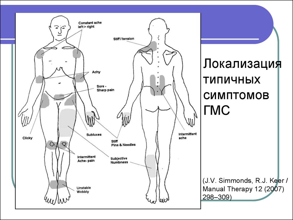 Дисплазия тканей. Типичные симптомы локализованный. Типичная локализация гидрадени. Типичная локализация продуктов.