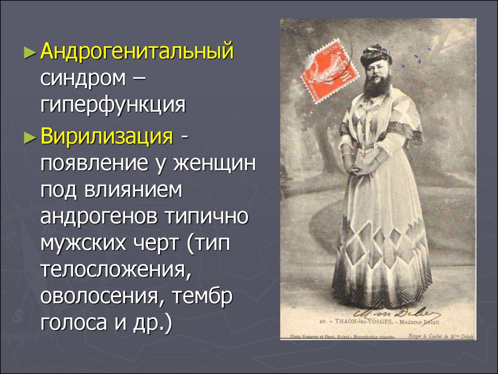 Появление женщина. Андрогены гипофункция и гиперфункция. Андрогенитальный синдром у женщин. Гиперфункция андрогенов у женщин. Гипо и гиперфункция андрогенов.