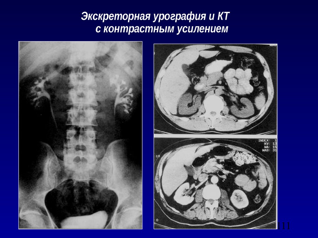 Лучевая диагностика брюшной полости презентация