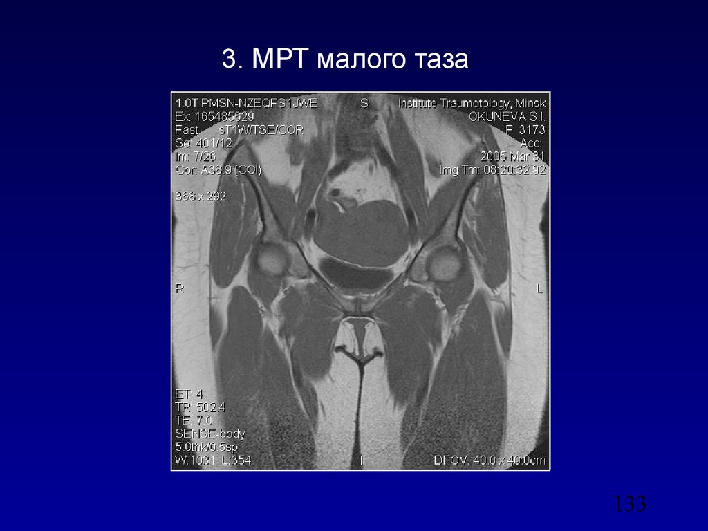 Мрт органов малого таза что показывает мужчин. Мрт малого таза. Мрт малого таза анатомия. Мрт малого таза у мужчин.