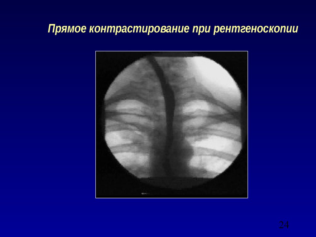 Лучевая диагностика брюшной полости презентация