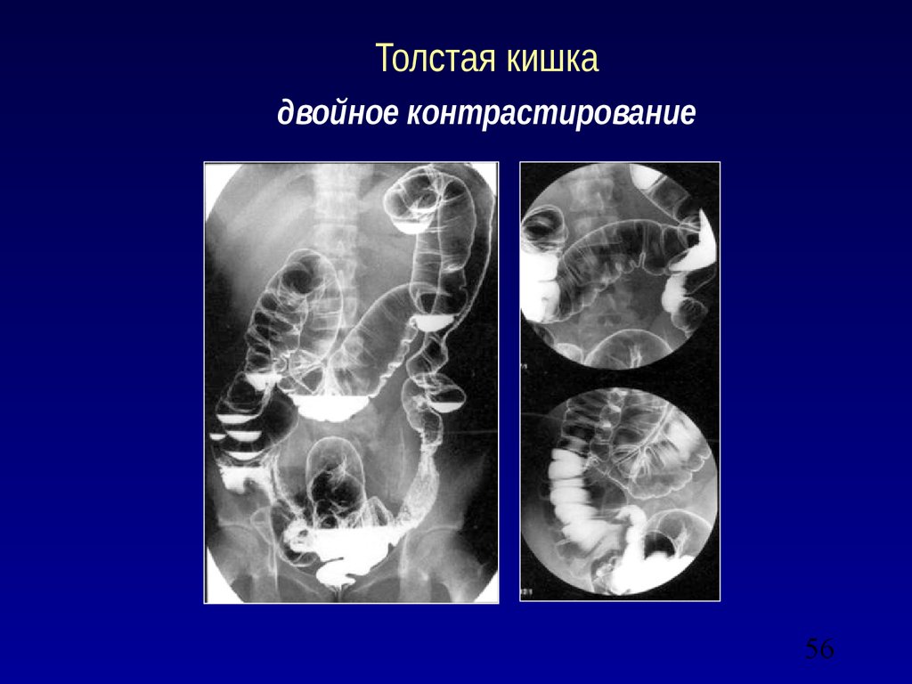 Лучевая диагностика брюшной полости презентация