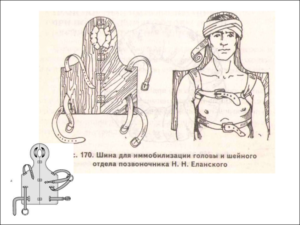 Методы временной и постоянной иммобилизации отломков челюстей презентация