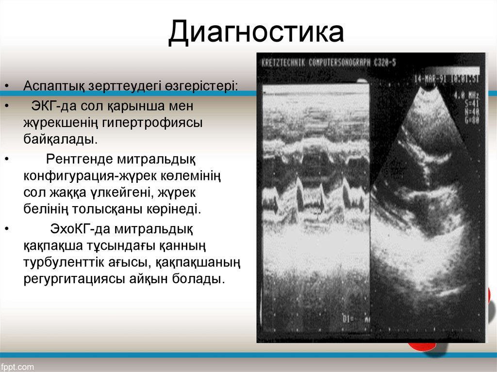 Диагностика