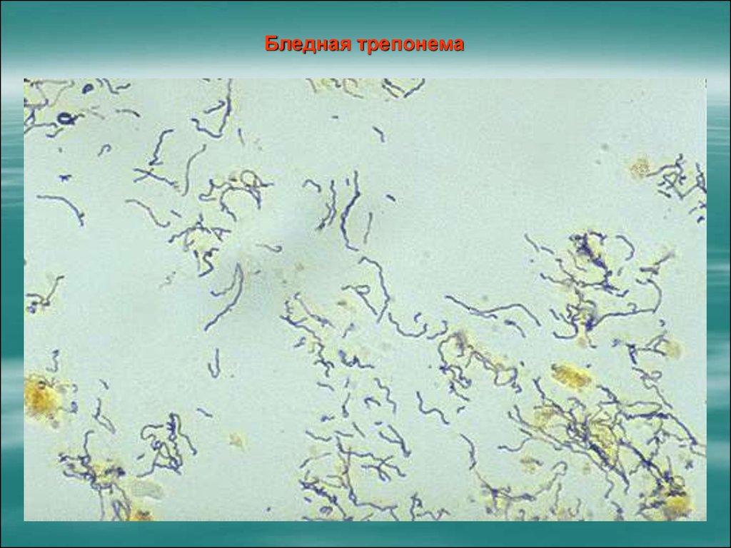 Бледная трепонема treponema pallidum. Бледная трепонема микроскоп. Бледная трепонема Романовский Гимзе. Трепонема микроскопия.