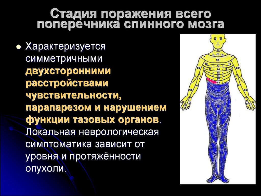 Этапы поражения. Стадия поражения всего поперечника спинного мозга. При поражении спинного мозга. Поражение поперечника спинного мозга. Поражение поперечника спинного мозга симптомы.