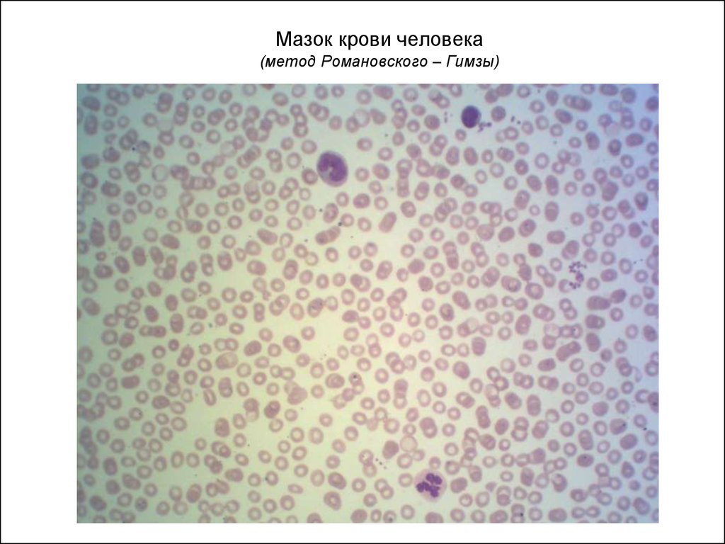 Мазок крови человека (метод Романовского – Гимзы)