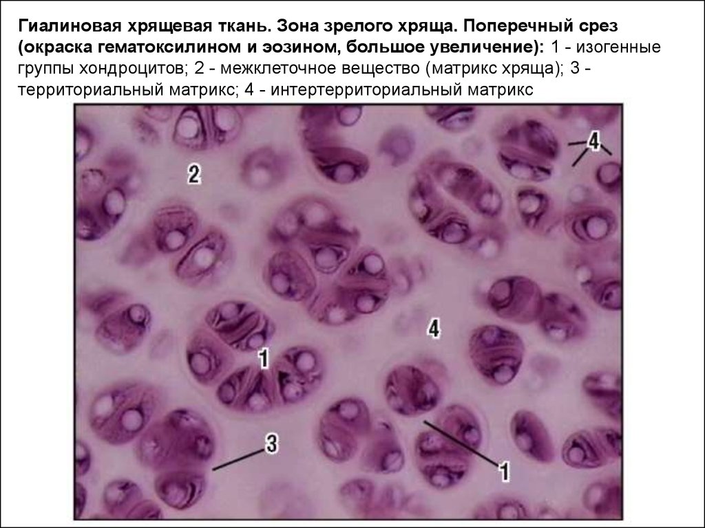 Межклеточная ткань. Соединительная ткань гиалиновый хрящ. Гиалиновый хрящ микрофотография. Гиалиновая хрящевая ткань. Гиалиновый хрящ территориальный Матрикс.