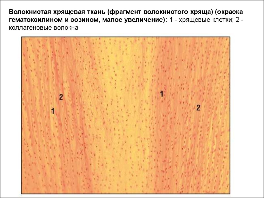 Волокнистый хрящ гистология