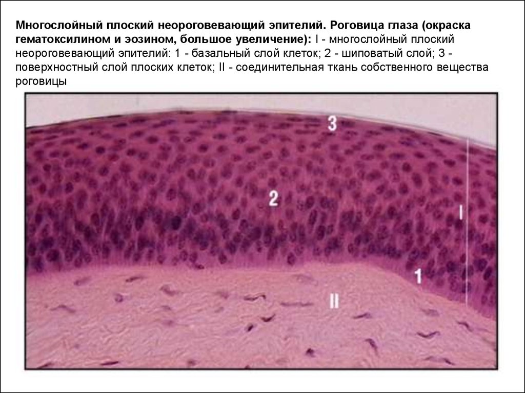 Роговица гистология. Многослойный плоский неороговевающий эпителий роговицы глаза. Многослойный плоский неороговевающий эпителий роговицы гистология. Многослойный плоский неороговевающий эпителий роговицы препарат. Многослойный плоский эпителий роговицы коровы.