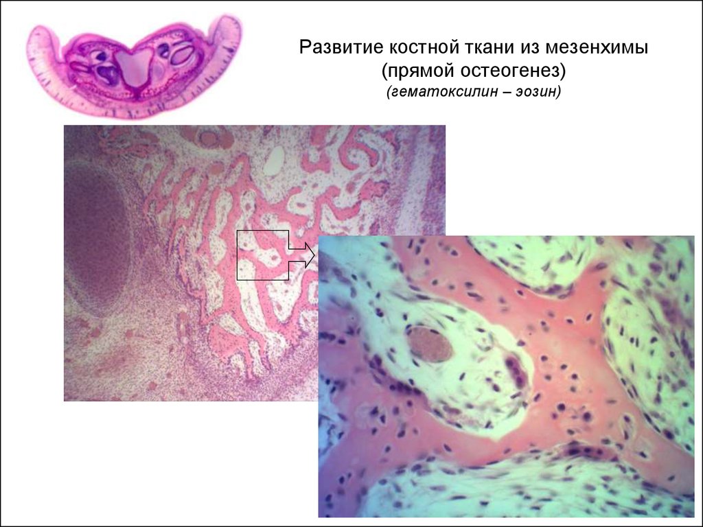Ткани зародыша. Костная ткань гематоксилин эозин. Развитие кости из соединительной ткани (мезенхимы). Кости из мезенхимы препарат гистология. Прямой остеогенез из мезенхимы препарат гистология.