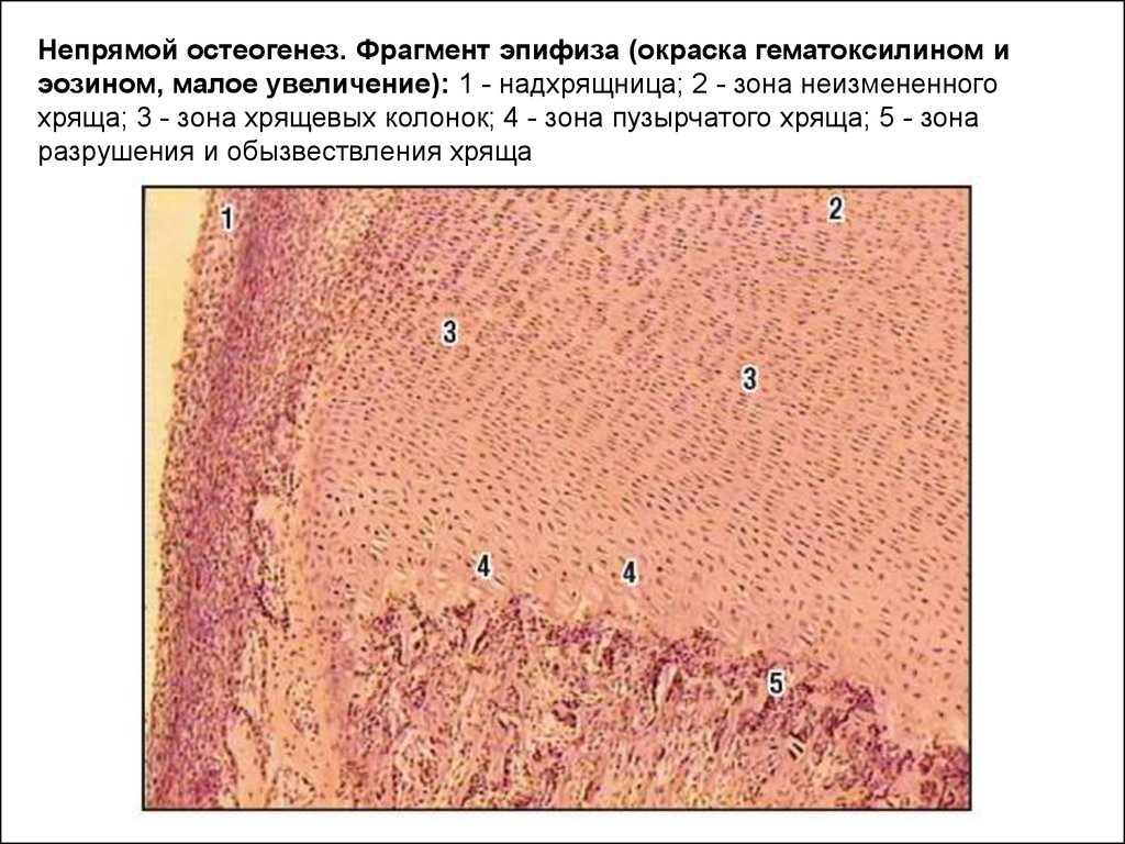 Развитие кости на месте хряща гистология рисунок