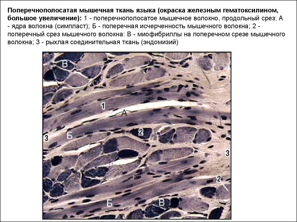 Многоядерная ткань. Поперечно-полосатая мышечная ткань языка Железный гематоксилин. Поперечнополосатая ткань Железный гематоксилин. Поперечно полосатая мышечная ткань языка кролика гистология. Поперечнополосатая мышечная ткань языка срез гистология препарат.