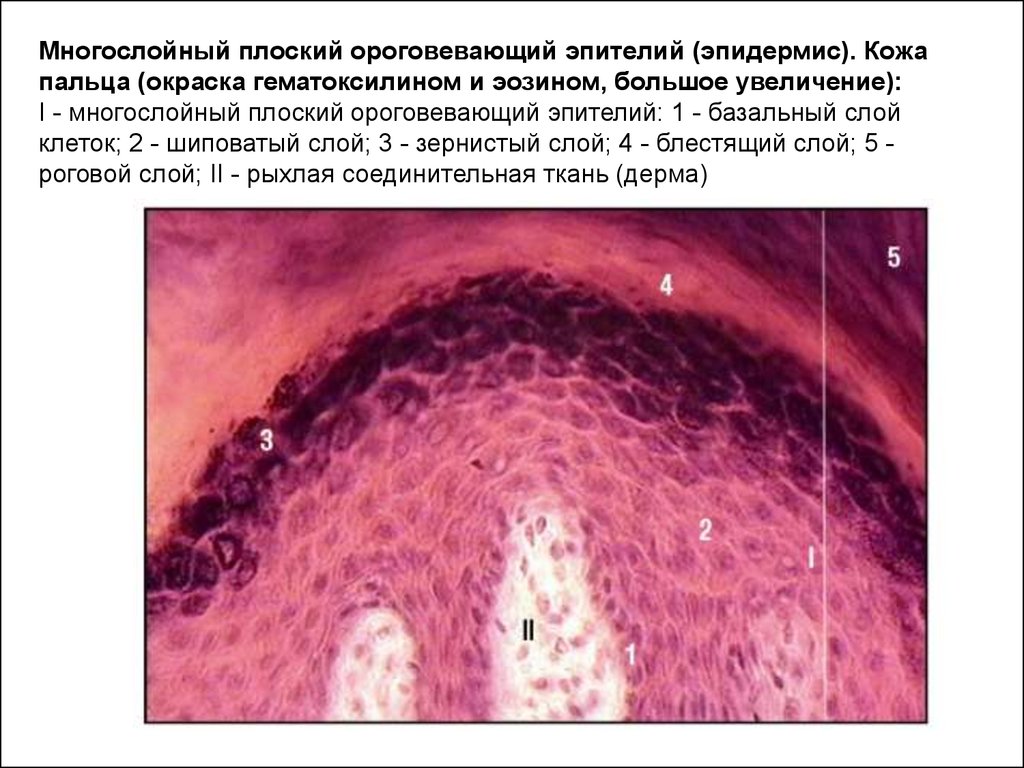 Многослойный плоский ороговевающий эпителий кожи пальца рисунок