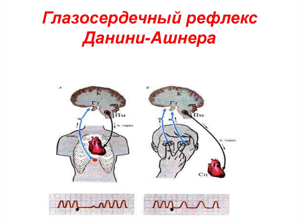 Схема рефлекторной дуги глазосердечного рефлекса