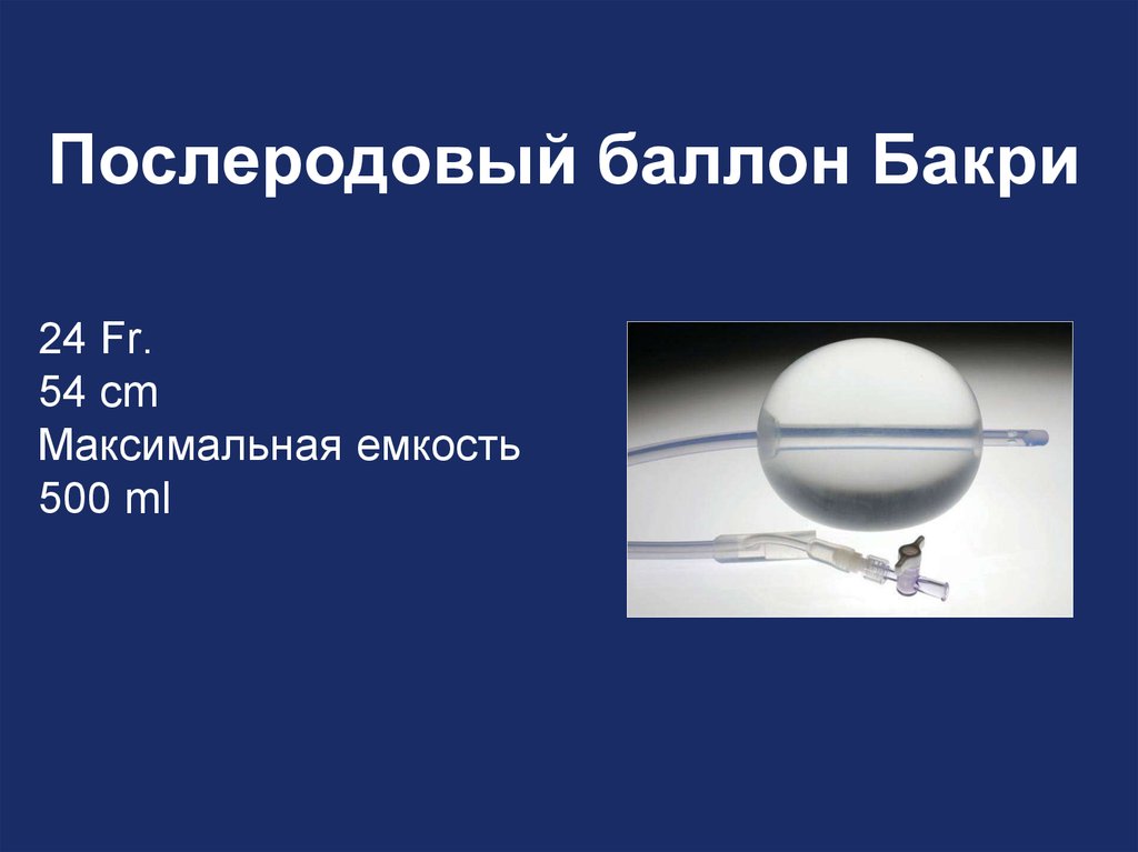 Максимальная емкость. Акушерский баллон Бакри. Баллонная тампонада- катетер Бакри. Баллон Бакри и катетер Жуковского.