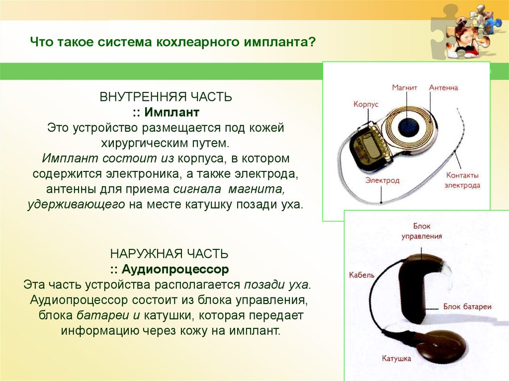 Устройство кохлеарного импланта