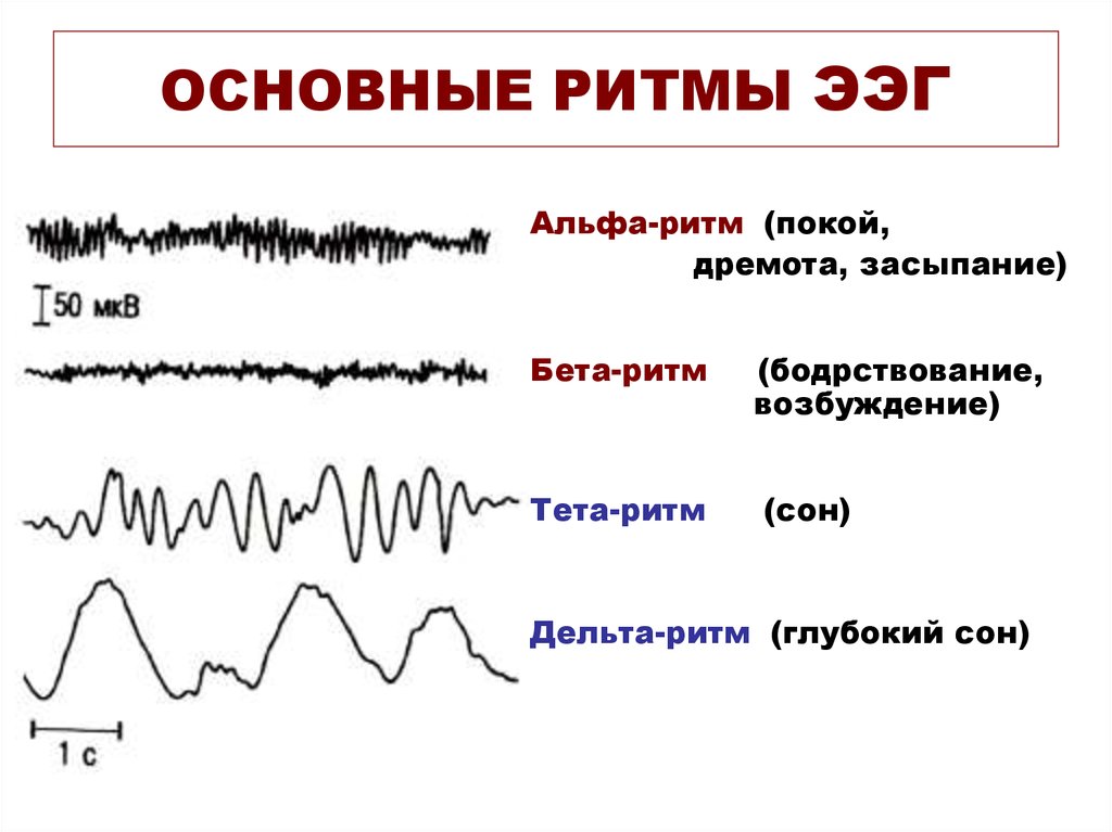Регистрация активности мозга. Ритмы ЭЭГ физиология. Частотный диапазон Альфа ритма на ЭЭГ. Альфа ритм ЭЭГ. Параметры Альфа ритма на ЭЭГ.