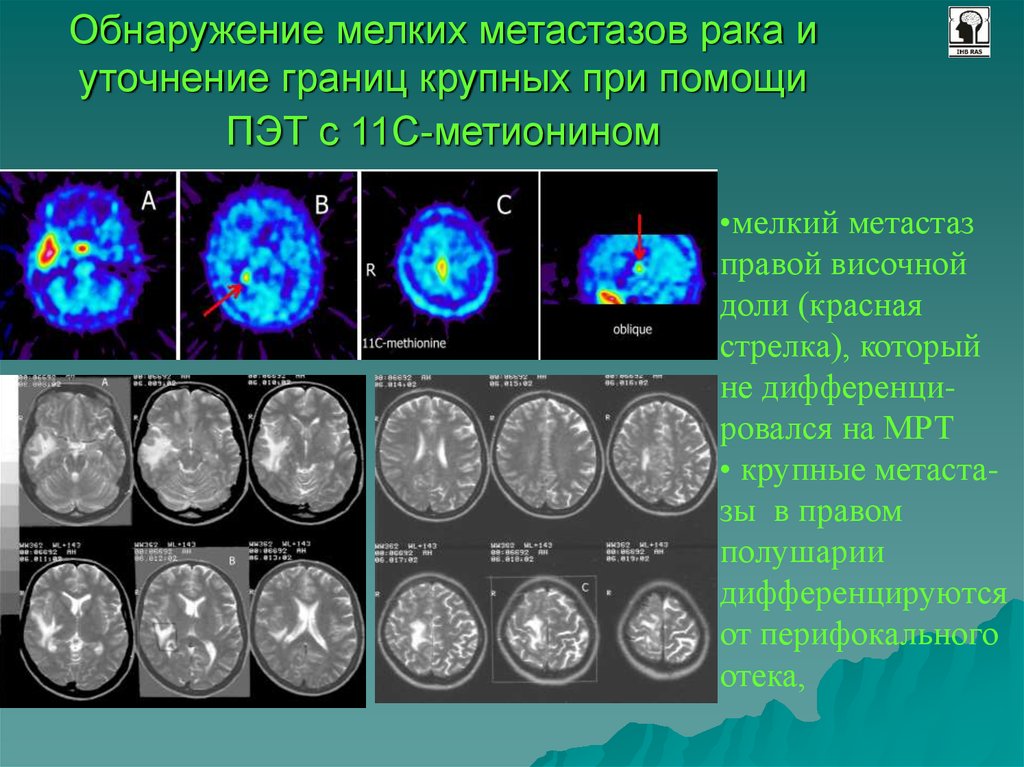 Пэт кт является изображением