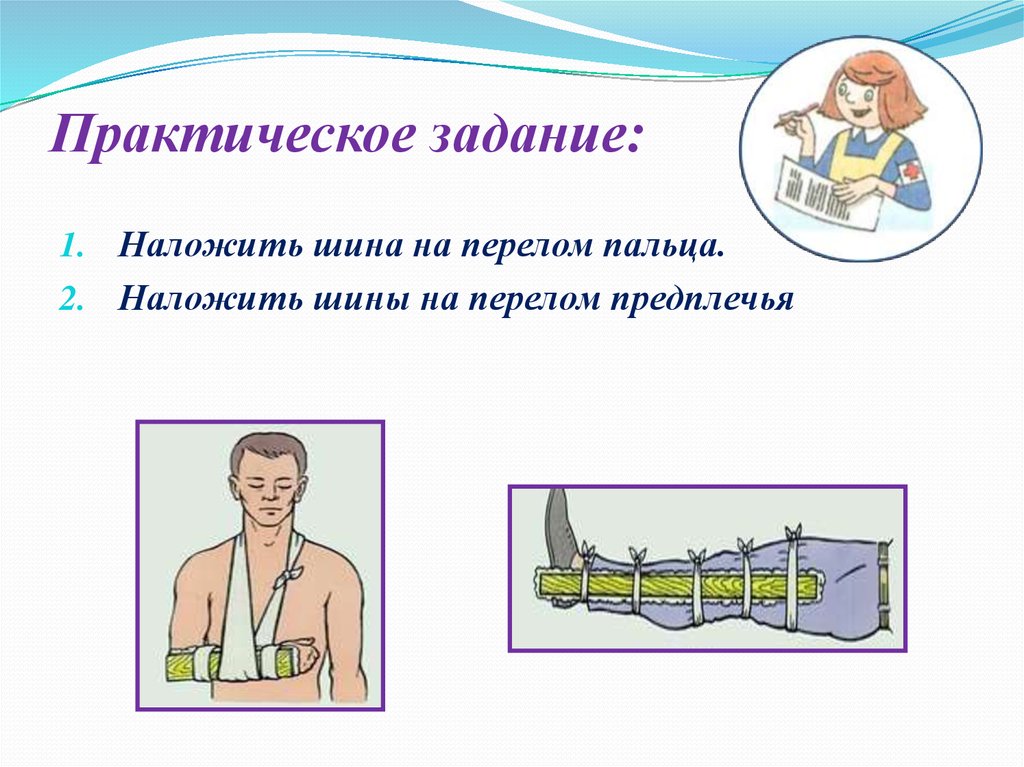 Основы медицинских знаний и здорового образа жизни. При переломе предплечья шина накладывается. При переломе костей предплечья шина накладывается. Как наложить шину при переломе костей предплечья?.