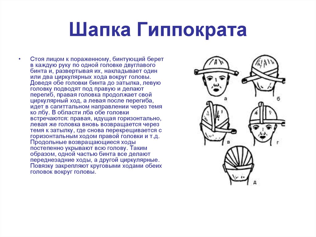 Чепец гиппократа повязка. Повязка шапка Гиппократа техника наложения. Повязка шапка Гиппократа техника наложения алгоритм. Техника наложения шапочки Гиппократа. Схема наложения повязки шапочка Гиппократа.