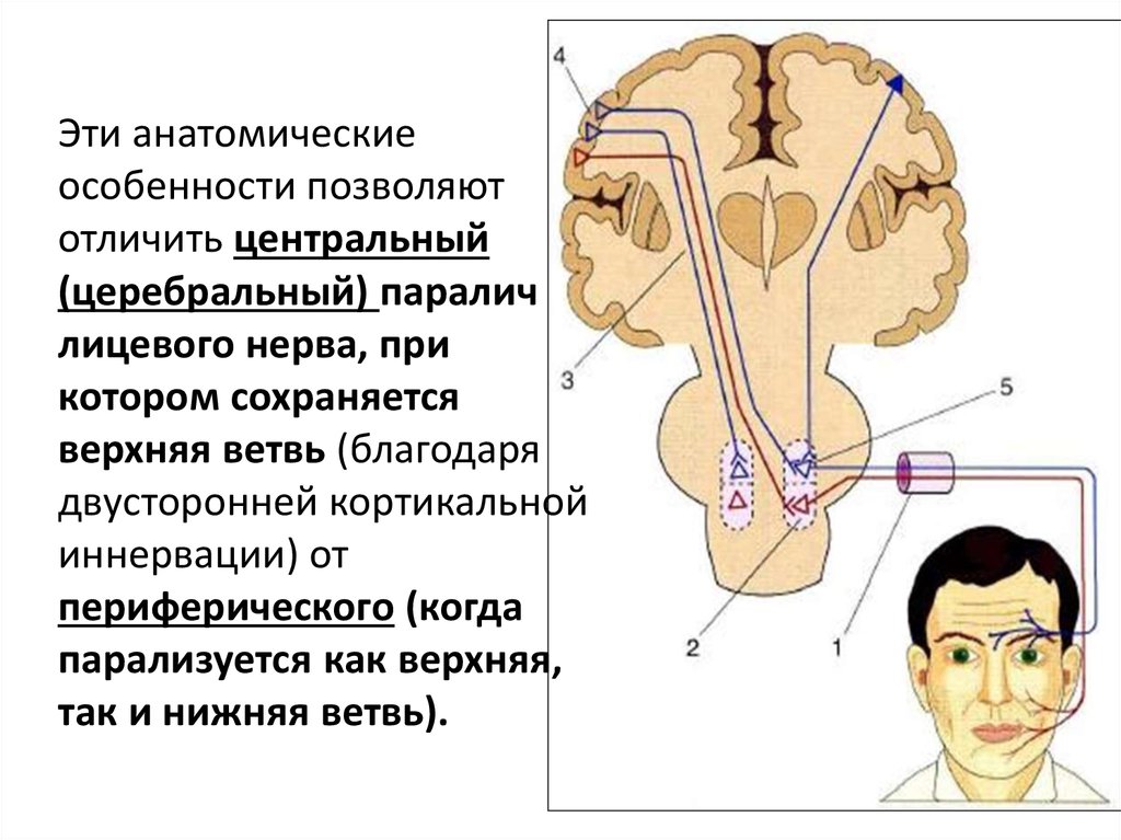 Лицевой нерв диагноз. Дифференциальная диагностика периферического пареза лицевого нерва. Дифференциальный диагноз периферический парез лицевого нерва. Синдромы периферического и центрального параличей лицевого нерва. Клиника центрального и периферического паралича лицевого нерва.