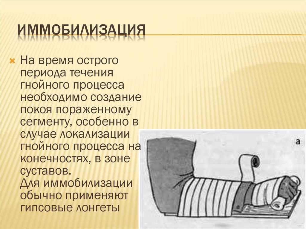 Острая иммобилизация. Иммобилизация. Иммобилизация при травме шейного отдела позвоночника. Иммобилизация в постели. Как необходимо провести иммобилизацию позвоночника.