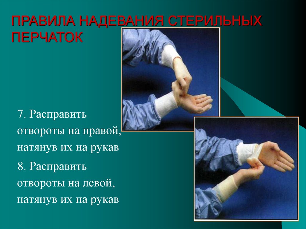 Надевать стерильные перчатки в случаях. Снятие стерильных перчаток алгоритм. Схема надевания стерильных перчаток. Одевание стерильных перчаток. Одевание хирургических перчаток.