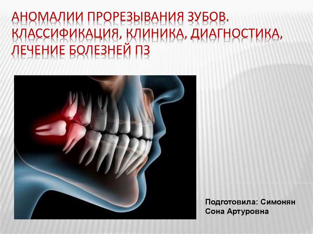 Болезни прорезывания зубов презентация