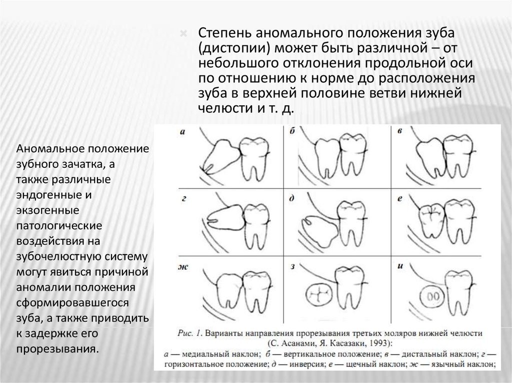 Нижняя челюсть аномалии развития