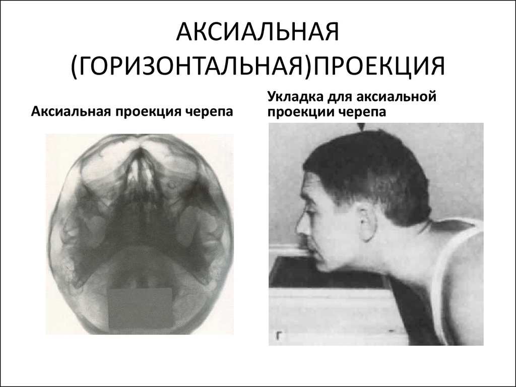 Рентген укладки в картинках и названия для рентгенолаборантов