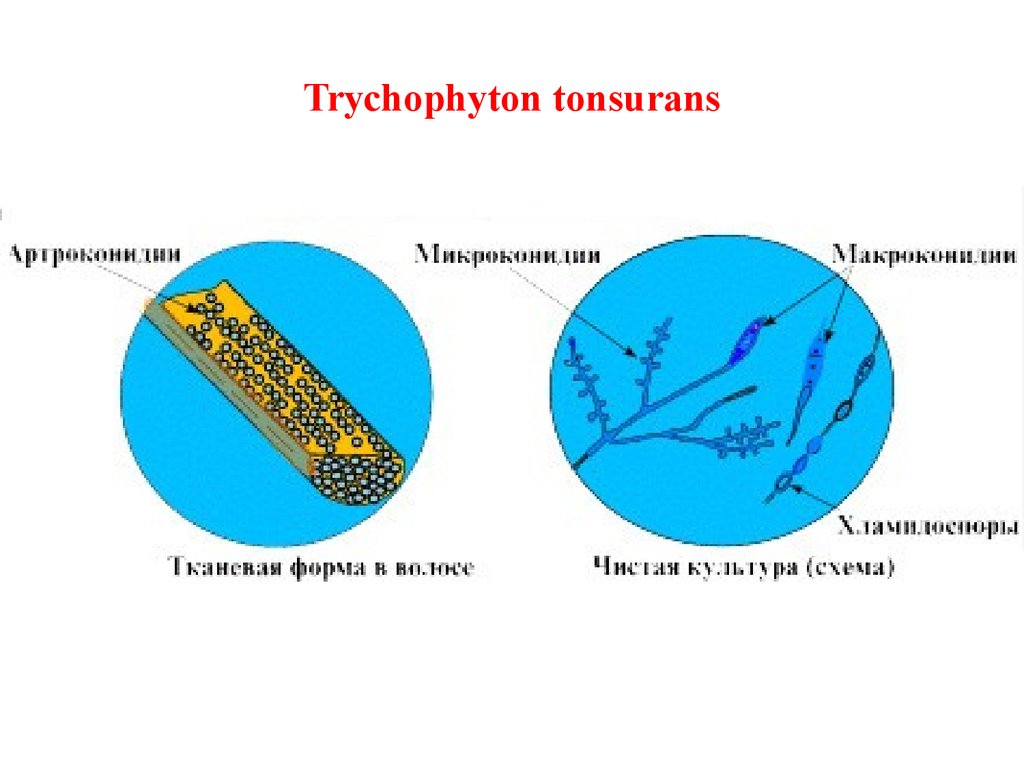 Тип поражения волос endothrix картинка