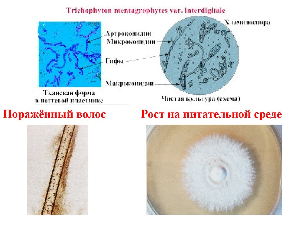 Патогенные грибы. Патогенные грибы микробиология. Рост грибов микробиология. Дерматофиты рост на питательной среде. Методы лабораторной диагностики плесневых грибов..