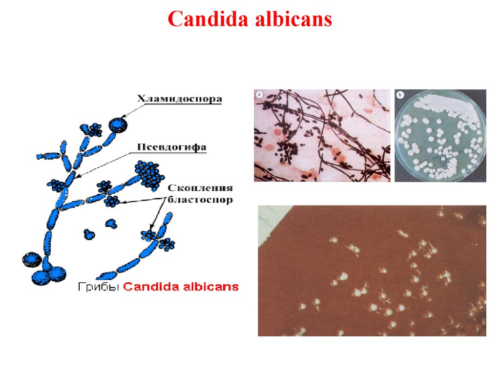 Споры candida. Грибы рода кандида альбиканс. Дрожжеподобные грибы рода кандида. Грибы рода Candida микробиология. Грибы аспергилл кандида.