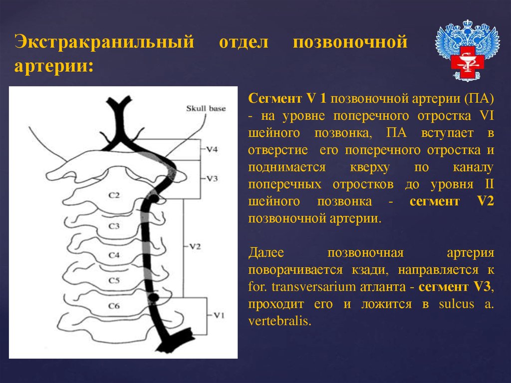 Сегмент v4 правой позвоночной артерии. Сегменты v1 v2 позвоночных артерий. Позвоночная артерия с3 с4 сегмент. Сегмент v2 позвоночной артерии. Ход позвоночных артерий сегменты v2.