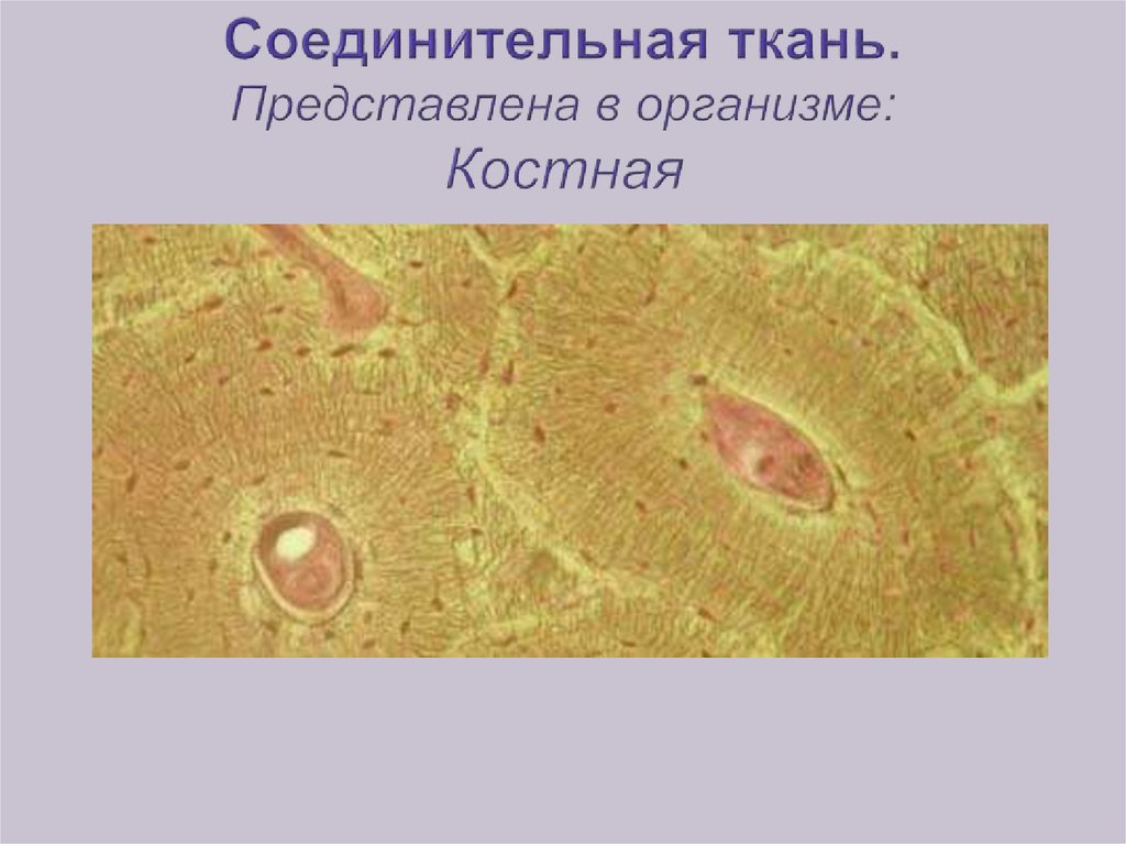 Соединительная ткань. Представлена в организме: Костная