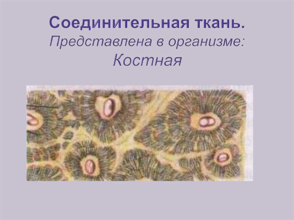 Соединительная ткань. Представлена в организме: Костная