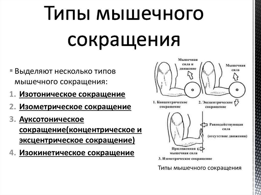 Типы сокращений. Изометрический Тип мышечного сокращения. Основные типы мышечного сокращения. Ауксотоническое мышечное сокращение. Изотонический Тип сокращения мышц.