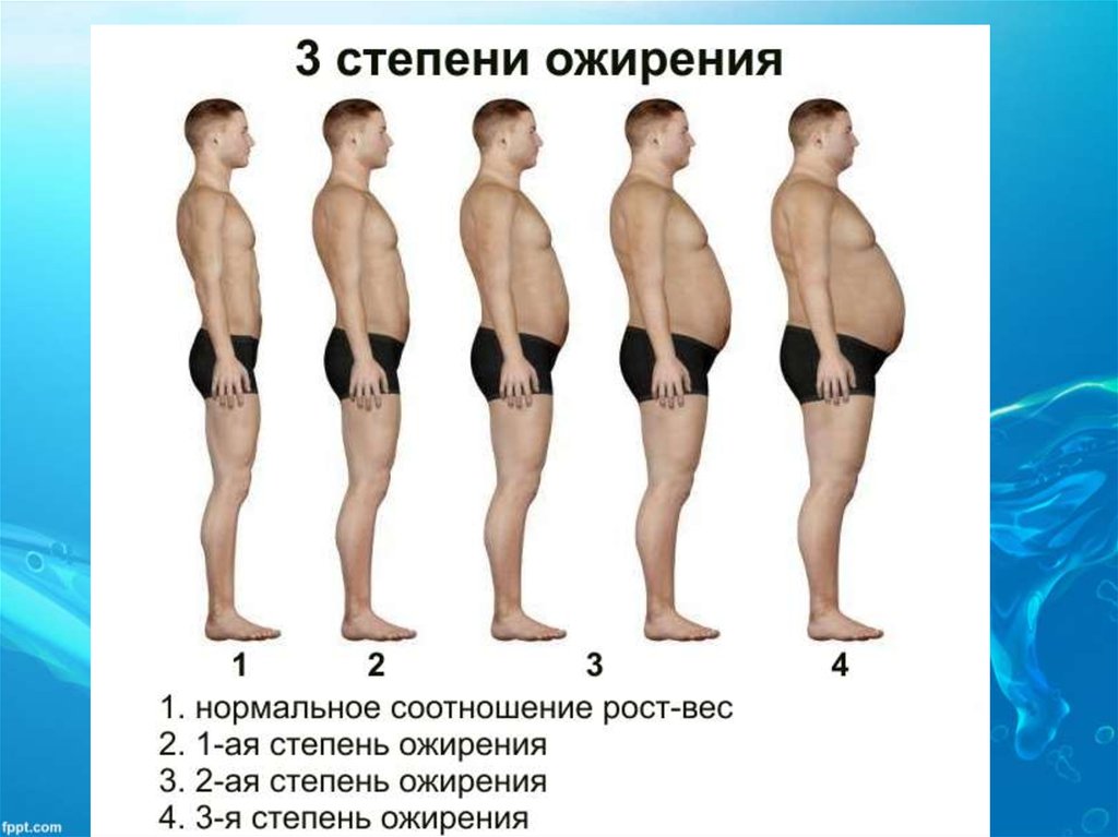 Ожирение 2 степени фото