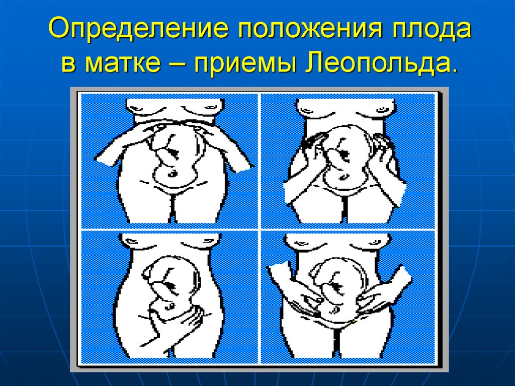 Положение плода. Определение положения плода. Положение плода определяется. Положение и позиция плода.