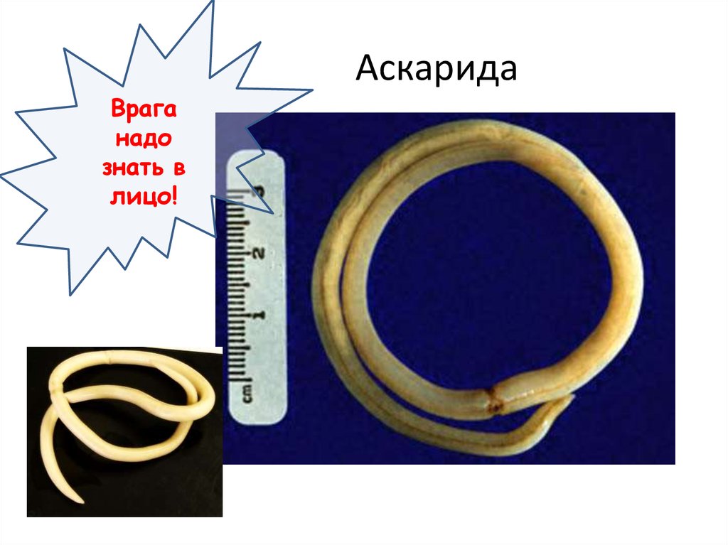 Аскарида обитает